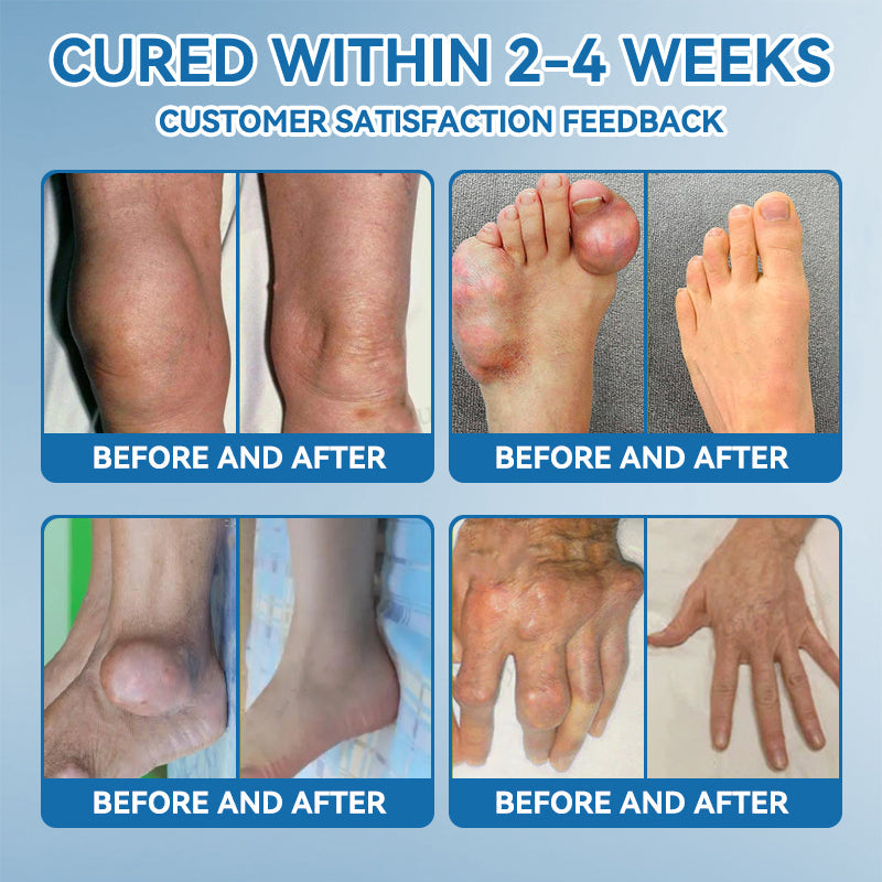 𝖯𝗂𝖼𝗱𝗼® BPC-157 Joint Healing Cream🦴Treats Arthritis, Neuropathy, Rheumatism, Sports Injuries & More👍