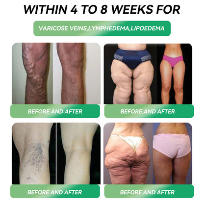 𝐌𝐚𝐯𝐨 𝐫𝐞𝐜𝐨𝐦𝐦𝐞𝐧𝐝𝐬 | 👨‍⚕️ 𝐂𝐲𝐞𝐫𝐚𝐨𝐥𝐦𝐝𝐞™ 𝐆𝐋𝐏-𝟏 𝟔-𝐢𝐧-𝟏 𝐇𝐞𝐚𝐥𝐭𝐡𝐲 𝐌𝐞𝐭𝐚𝐛𝐨𝐥𝐢𝐜 𝐑𝐞𝐠𝐮𝐥𝐚𝐭𝐨𝐫 (𝐨𝐧𝐜𝐞 𝐝𝐚𝐢𝐥𝐲, 𝐬𝐞𝐞 𝐬𝐢𝐠𝐧𝐢𝐟𝐢𝐜𝐚𝐧𝐭 𝐜𝐡𝐚𝐧𝐠𝐞𝐬 𝐢𝐧 𝟕 𝐝𝐚𝐲𝐬) 𝐟𝐨𝐫 𝐨𝐛𝐞𝐬𝐢𝐭𝐲, 𝐜𝐚𝐫𝐝𝐢𝐨𝐯𝐚𝐬𝐜𝐮𝐥𝐚𝐫 𝐡𝐞𝐚𝐥𝐭𝐡, 𝐝𝐢𝐚𝐛𝐞𝐭𝐞𝐬, 𝐬𝐥𝐞𝐞𝐩 𝐚𝐩𝐧𝐞𝐚, 𝐠𝐮𝐭 𝐡𝐞𝐚𝐥𝐭𝐡, 𝐣𝐨𝐢𝐧𝐭 𝐩𝐫𝐨𝐛𝐥𝐞𝐦𝐬, 𝐚𝐧𝐝 𝐦𝐨𝐫𝐞🍀