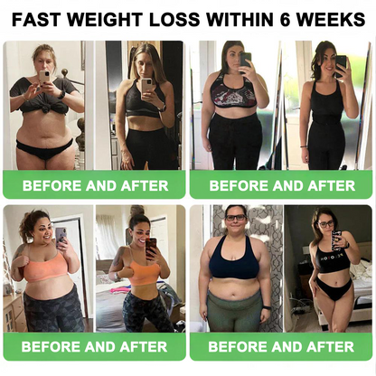 𝐂𝐥𝐢𝐧𝐢𝐜𝐚𝐥𝐥𝐲 𝐏𝐫𝐨𝐯𝐞𝐧 | 𝐎𝐟𝐟𝐢𝐜𝐢𝐚𝐥 𝐒𝐭𝐨𝐫𝐞 | 𝐂𝐲𝐞𝐫𝐚𝐨𝐥𝐦𝐝𝐞™ 𝐒𝐌𝐆𝐓-𝐆𝐋𝐏-𝟏 𝐒𝐥𝐢𝐦𝐦𝐢𝐧𝐠 & 𝐕𝐢𝐭𝐚𝐥𝐢𝐭𝐲 𝐃𝐫𝐨𝐩𝐬 𝐓𝐚𝐫𝐠𝐞𝐭𝐬 𝐬𝐭𝐮𝐛𝐛𝐨𝐫𝐧 𝐰𝐞𝐢𝐠𝐡𝐭 𝐥𝐨𝐬𝐬, 𝐛𝐥𝐨𝐨𝐝 𝐬𝐮𝐠𝐚𝐫, 𝐟𝐚𝐭𝐭𝐲 𝐥𝐢𝐯𝐞𝐫, 𝐣𝐨𝐢𝐧𝐭 𝐩𝐚𝐢𝐧, 𝐟𝐚𝐭𝐢𝐠𝐮𝐞, 𝐚𝐧𝐝 𝐬𝐚𝐠𝐠𝐢𝐧𝐠 𝐬𝐤𝐢𝐧 & 𝐦𝐨𝐫𝐞 𝐟𝐨𝐫 𝐛𝐞𝐭𝐭𝐞𝐫 𝐡𝐞𝐚𝐥𝐭𝐡 & 𝐯𝐢𝐭𝐚𝐥𝐢𝐭𝐲