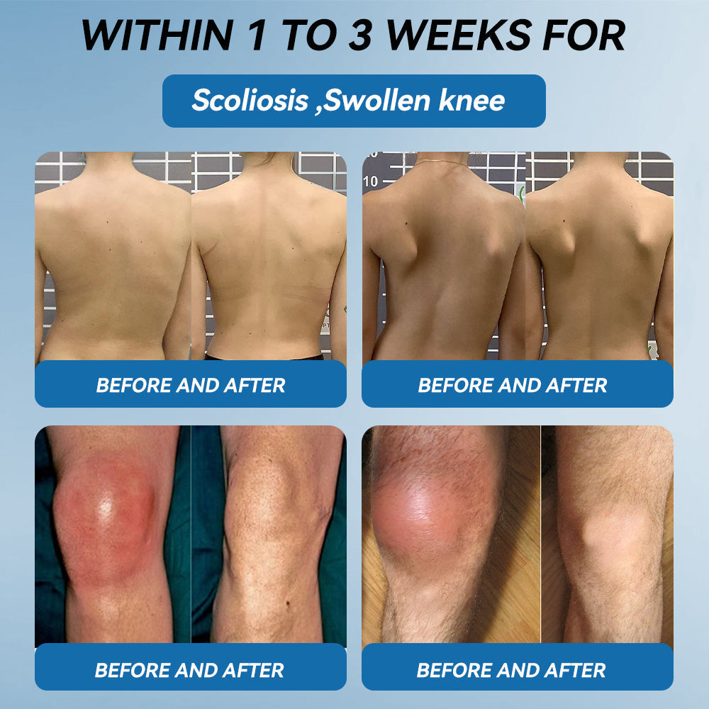 𝖯𝗂𝖼𝗱𝗼® BPC-157 Joint Healing Cream🦴Treats Arthritis, Neuropathy, Rheumatism, Sports Injuries & More👍