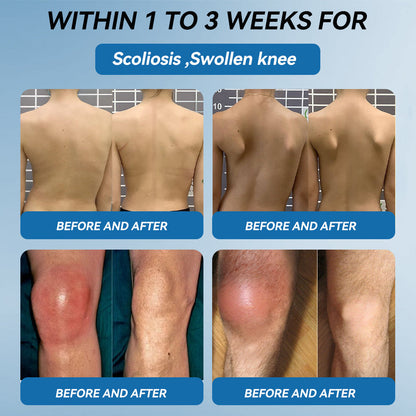 𝖯𝗂𝖼𝗱𝗼® BPC-157 Joint Healing Cream🦴Treats Arthritis, Neuropathy, Rheumatism, Sports Injuries & More👍