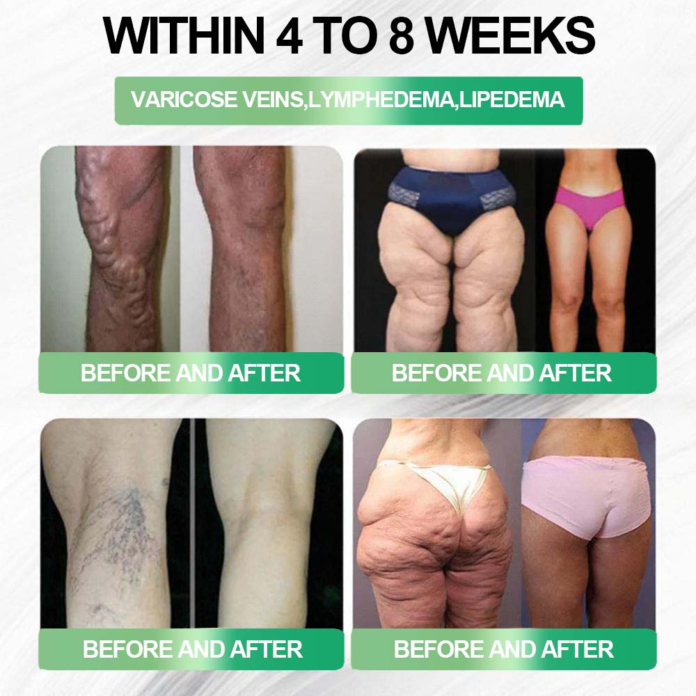 🔥𝐂𝐲𝐞𝐫𝐚𝐨𝐥𝐦𝐝𝐞™ GL𝐏-1 8-𝒊𝒏-1 𝙁𝙞𝙩 & 𝙑𝙞𝙩𝙖𝙡 𝖮𝗋𝖺𝗅 𝙎𝙤𝙡𝙪𝙩𝙞𝙤𝙣  (𝑱𝒖𝒔𝒕 𝒐𝒏𝒄𝒆 𝒂 𝒅𝒂𝒚, 𝒗𝒊𝒔𝒊𝒃𝒍𝒆 𝒄𝒉𝒂𝒏𝒈𝒆𝒔 𝒊𝒏 7 𝒅𝒂𝒚𝒔) ✅ 𝑭𝒐𝒓 𝒐𝒃𝒆𝒔𝒊𝒕𝒚, 𝒄𝒂𝒓𝒅𝒊𝒐𝒗𝒂𝒔𝒄𝒖𝒍𝒂𝒓 𝒉𝒆𝒂𝒍𝒕𝒉, 𝒅𝒊𝒂𝒃𝒆𝒕𝒆𝒔, 𝒔𝒍𝒆𝒆𝒑 𝒂𝒑𝒏𝒆𝒂, 𝒈𝒖𝒕 𝒉𝒆𝒂𝒍𝒕𝒉, 𝒋𝒐𝒊𝒏𝒕 𝒊𝒔𝒔𝒖𝒆𝒔, 𝒂𝒏𝒅 𝒎𝒐𝒓𝒆🍀