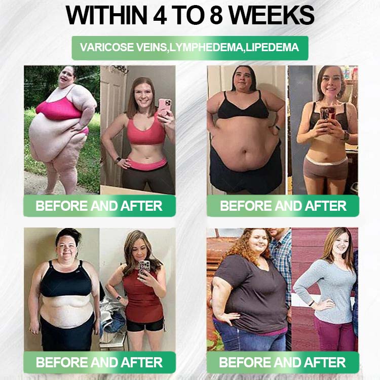 🔥𝐂𝐲𝐞𝐫𝐚𝐨𝐥𝐦𝐝𝐞™ GL𝐏-1 8-𝒊𝒏-1 𝙁𝙞𝙩 & 𝙑𝙞𝙩𝙖𝙡 𝖮𝗋𝖺𝗅 𝙎𝙤𝙡𝙪𝙩𝙞𝙤𝙣  (𝑱𝒖𝒔𝒕 𝒐𝒏𝒄𝒆 𝒂 𝒅𝒂𝒚, 𝒗𝒊𝒔𝒊𝒃𝒍𝒆 𝒄𝒉𝒂𝒏𝒈𝒆𝒔 𝒊𝒏 7 𝒅𝒂𝒚𝒔) ✅ 𝑭𝒐𝒓 𝒐𝒃𝒆𝒔𝒊𝒕𝒚, 𝒄𝒂𝒓𝒅𝒊𝒐𝒗𝒂𝒔𝒄𝒖𝒍𝒂𝒓 𝒉𝒆𝒂𝒍𝒕𝒉, 𝒅𝒊𝒂𝒃𝒆𝒕𝒆𝒔, 𝒔𝒍𝒆𝒆𝒑 𝒂𝒑𝒏𝒆𝒂, 𝒈𝒖𝒕 𝒉𝒆𝒂𝒍𝒕𝒉, 𝒋𝒐𝒊𝒏𝒕 𝒊𝒔𝒔𝒖𝒆𝒔, 𝒂𝒏𝒅 𝒎𝒐𝒓𝒆🍀